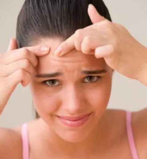 Schermata guide to Get rid of Acne 1